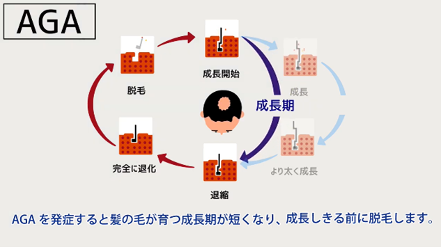 AGAのヘアサイクルについての説明